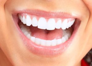 Smile with White Teeth – Rochester, Mn – Apollo Dental